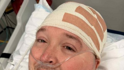 首個腦植入晶片 Neuralink N1 真人 100 日體驗：用意念控制電腦兼玩魔獸世界