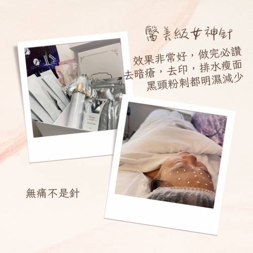 女神針療程