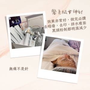 女神針療程