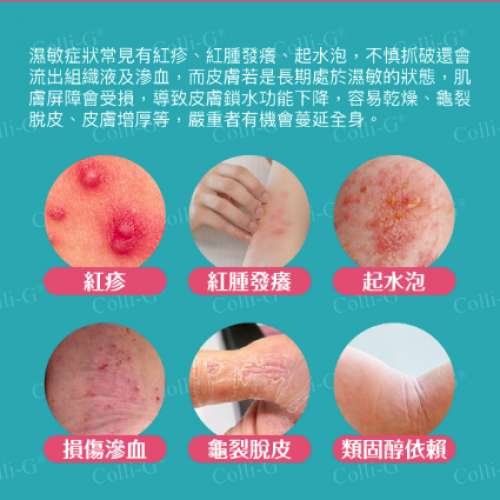 Colli-G 濕敏樂 ECZECURE - 6盒 順豐包郵