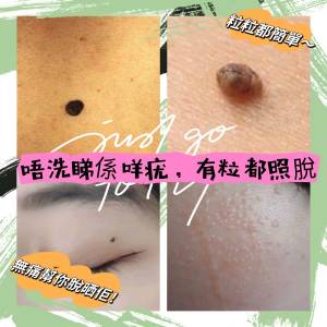 脫疣 脫粒 脫肉芽 脫默 脫斑