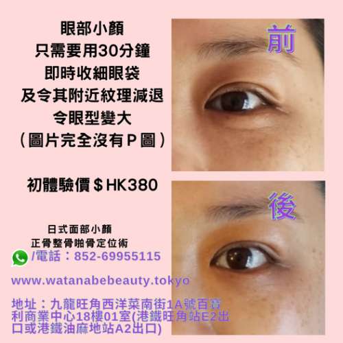渡邊小顏：小顏整骨正骨（ 針對皮膚和肌肉及骨骼層面）