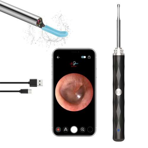 智慧型挖耳匙可視採耳儀高清掏耳鏡工具耳朵清潔器發光耳內視鏡