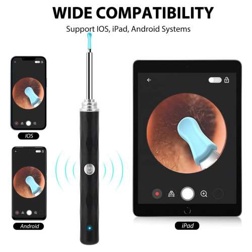 智慧型挖耳匙可視採耳儀高清掏耳鏡工具耳朵清潔器發光耳內視鏡