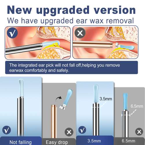 智慧型挖耳匙可視採耳儀高清掏耳鏡工具耳朵清潔器發光耳內視鏡