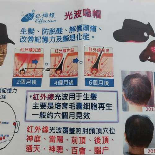 光波帽及光波面膜