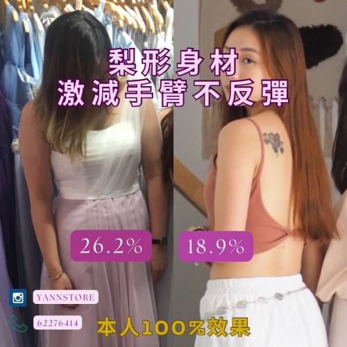 SOSM燃脂糖 (不是減肥藥❎) ✅解決頑固脂肪減內臟脂肪