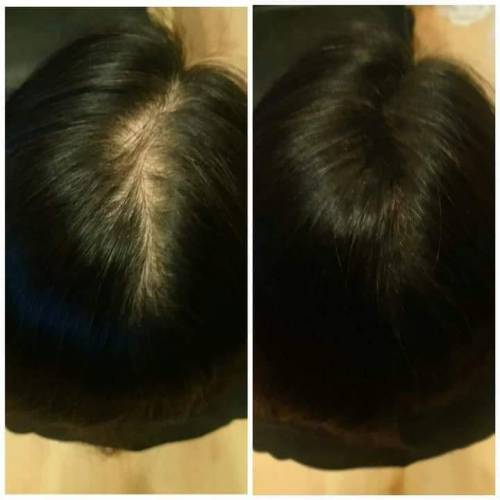 真實示範使用中!! 可令稀薄頭髮瞬間豐盈💁&zwj;♀️💁&zwj;♂️【Domo Fiber 炫豐髮粉】(1...