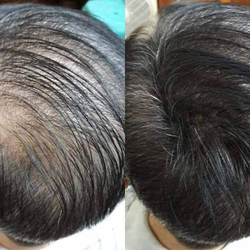 真實示範使用中!! 可令稀薄頭髮瞬間豐盈💁&zwj;♀️💁&zwj;♂️【Domo Fiber 炫豐髮粉】(1...