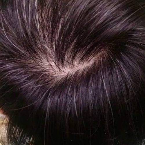 真實示範使用中!! 可令稀薄頭髮瞬間豐盈💁&zwj;♀️💁&zwj;♂️【Domo Fiber 炫豐髮粉】(1...