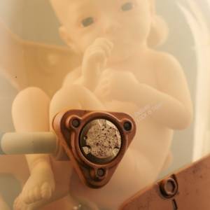 死亡擱淺 BB Pod 1/1“LIKE”版 小島製作