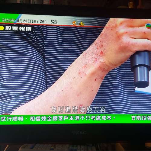 屯門良景輕鐵站交收, TEAC 24吋 數碼電視機 LED-2408 連火牛及OEM遙控 左邊角螢幕有...