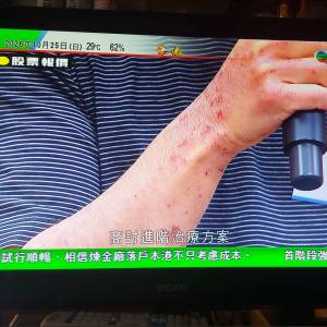 屯門良景輕鐵站交收, TEAC 24吋 數碼電視機 LED-2408 連火牛及OEM遙控 左邊角螢幕有...