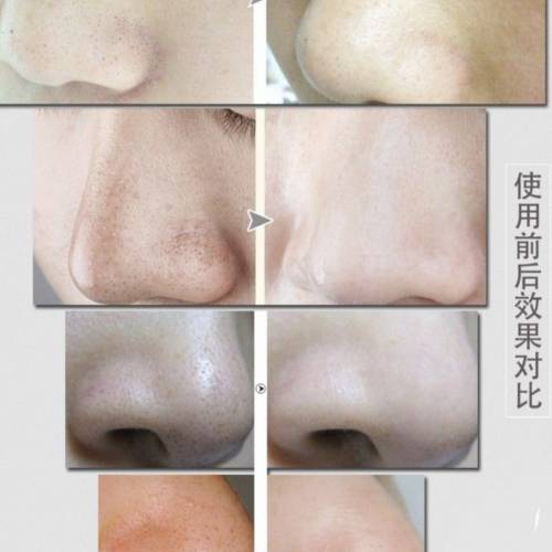 3in1美容豐胸儀